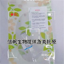 重組人結(jié)構(gòu)域蛋白2B（RWDD2B）蛋白