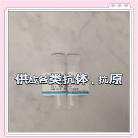 重組人去分支酶同系物1（DBR1）蛋白